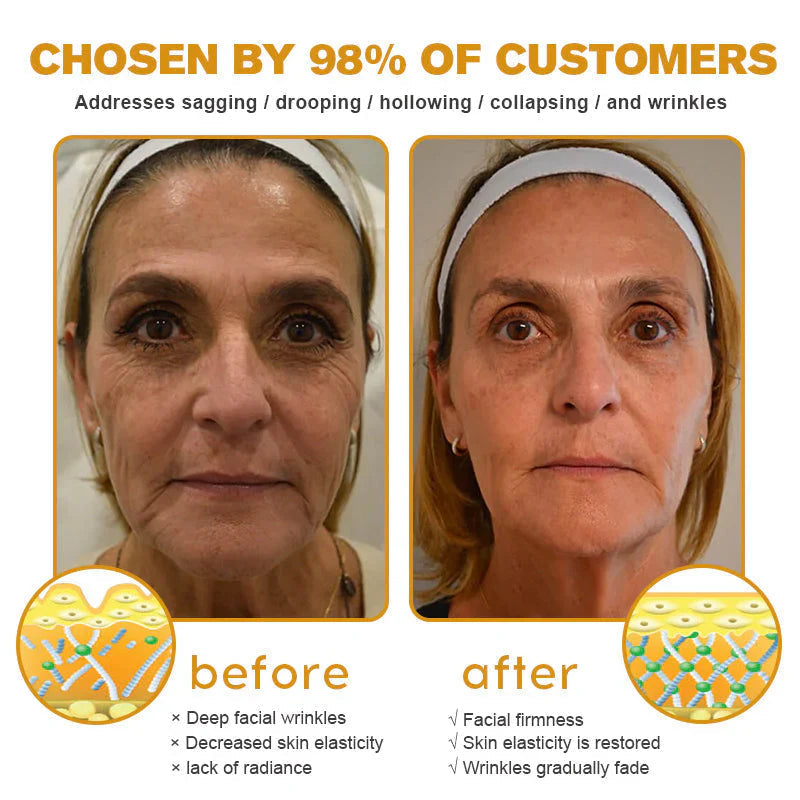 ✨ Bee Venom AGE-Defying Cream ✨ – 🌑 Fade Dark Spots · 🎯 Minimize Pores · 💎 Firm Skin in 14 Days 🚀 (Only 3 HOURS LEFT!)
