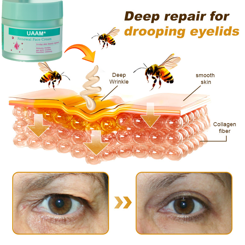 ✨ Bee Venom AGE-Defying Cream ✨ – 🌑 Fade Dark Spots · 🎯 Minimize Pores · 💎 Firm Skin in 14 Days 🚀 (Only 3 HOURS LEFT!)