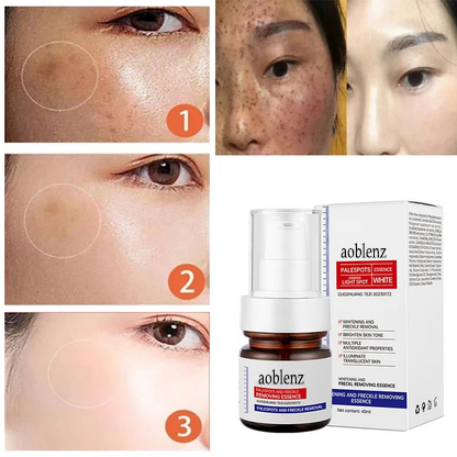 🔥7-Second Brightening: Eliminates dark spots, improves dullness, and reveals radiant skin. 🥇Vitamin C Spot-Fading Serum➡️(3 HOURS LEDFT!)