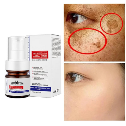 🔥7-Second Brightening: Eliminates dark spots, improves dullness, and reveals radiant skin. 🥇Vitamin C Spot-Fading Serum➡️(3 HOURS LEDFT!)