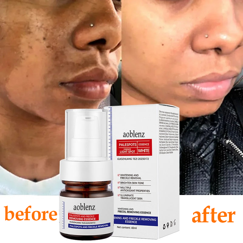 🔥7-Second Brightening: Eliminates dark spots, improves dullness, and reveals radiant skin. 🥇Vitamin C Spot-Fading Serum➡️(3 HOURS LEDFT!)